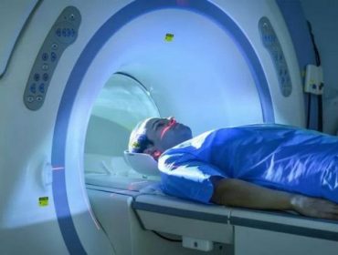 “Prolonged COVID-19: MRI scans revealed organ damage?”